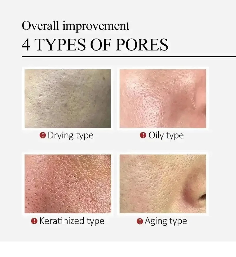 ツボクサエキス配合 毛穴縮小美容液 赤み緩和クリーム 保湿  - Luxury Skincare Korea のレビューと価格